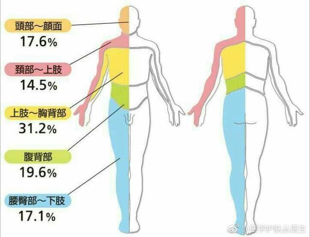 什么是带状疱疹，带状疱疹的治疗方法和措施