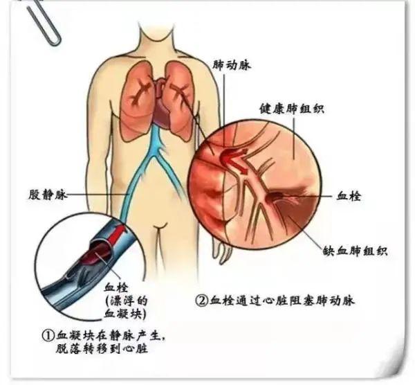 每天接单15小时，网约车司机进ICU