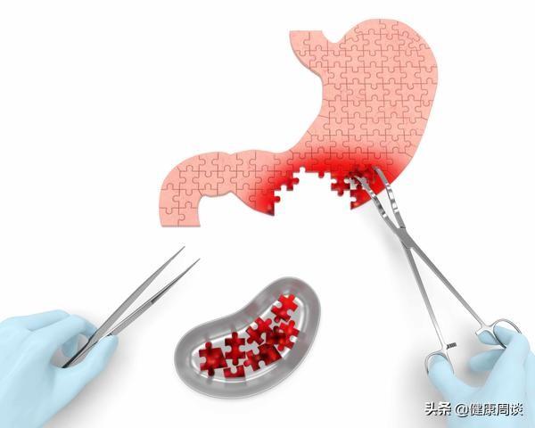 胃溃疡和十二指肠溃疡虽同属消化道疾病，但仍有4点区别，别搞混