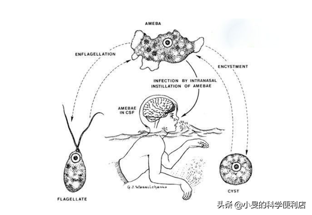 恐怖“食脑虫”入侵美国！死亡率达97%的食脑虫会传染到中国吗？