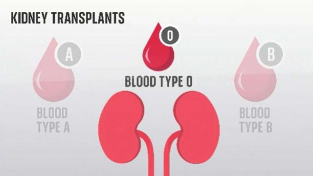 医学突破：科学家成功改变供体肾脏血型，或“颠覆游戏规则”