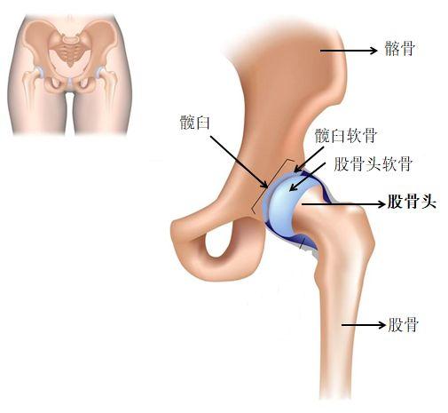 「筋骨堂」宝妈注意了！您不了解的“小儿股骨头坏死”