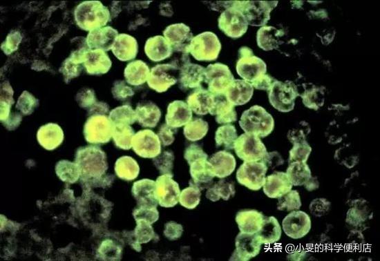 恐怖“食脑虫”入侵美国！死亡率达97%的食脑虫会传染到中国吗？