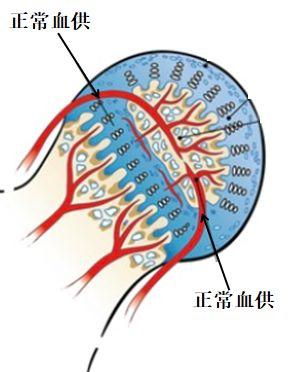 「筋骨堂」宝妈注意了！您不了解的“小儿股骨头坏死”