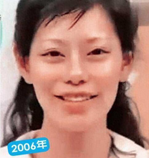 女子长得太丑选择整容，21年时间整容了60次，最终变成了美女