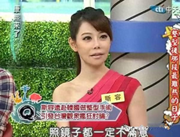 女子长得太丑选择整容，21年时间整容了60次，最终变成了美女